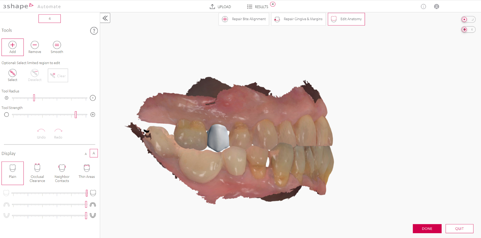 A close-up of a denture

Description automatically generated