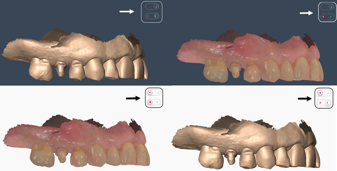 A collage of teeth and gums

Description automatically generated