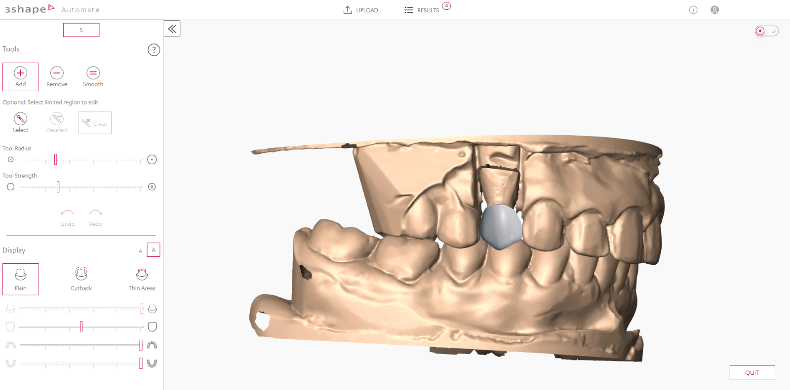 A close-up of a model of a human jaw

Description automatically generated