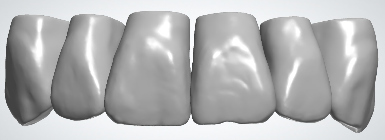 blobid173.png