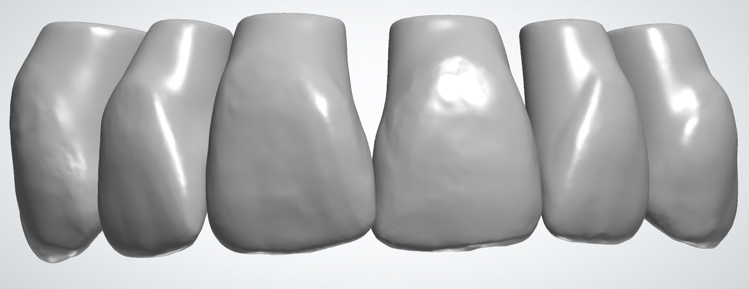 blobid194.png