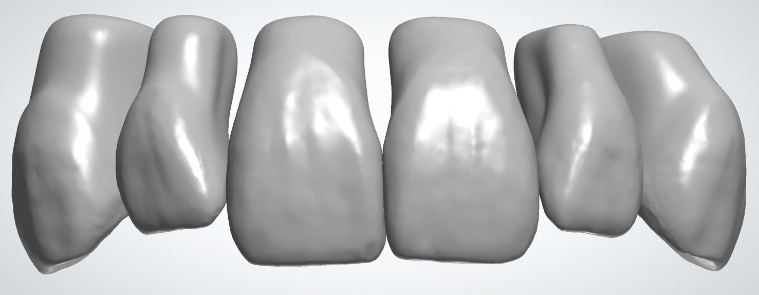 blobid208.png