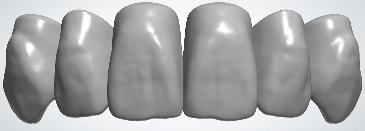 blobid384.png