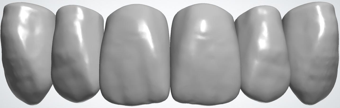 blobid412.png