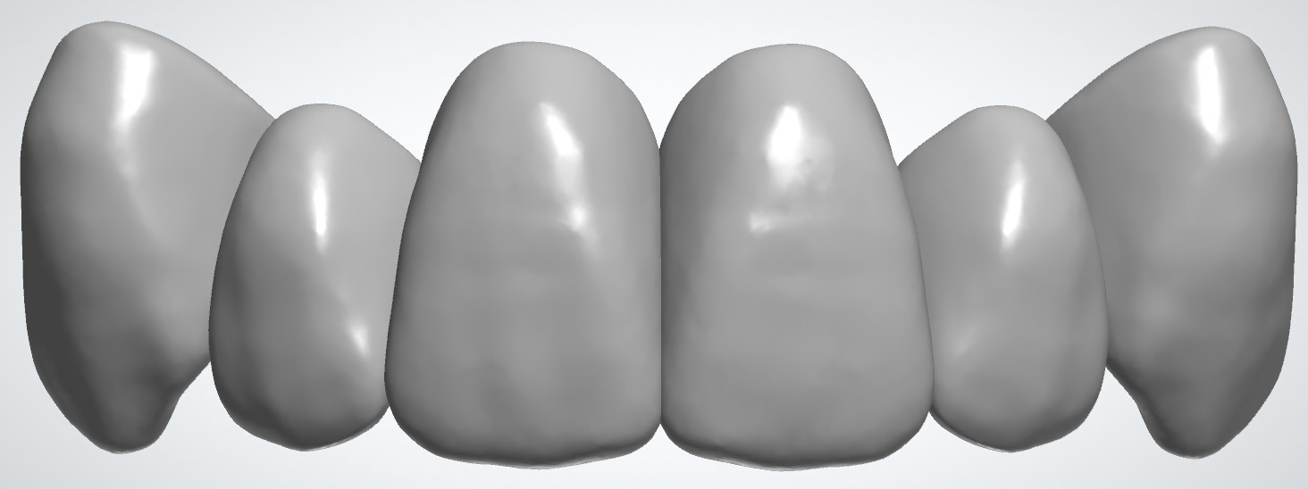 blobid414.png