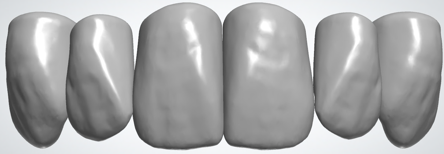 blobid416.png