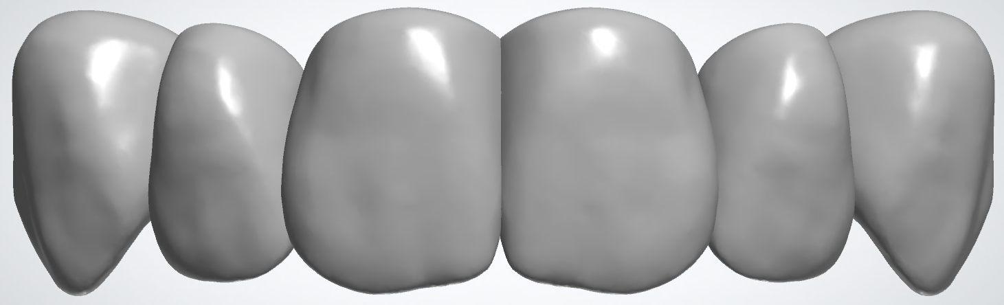 blobid422.png
