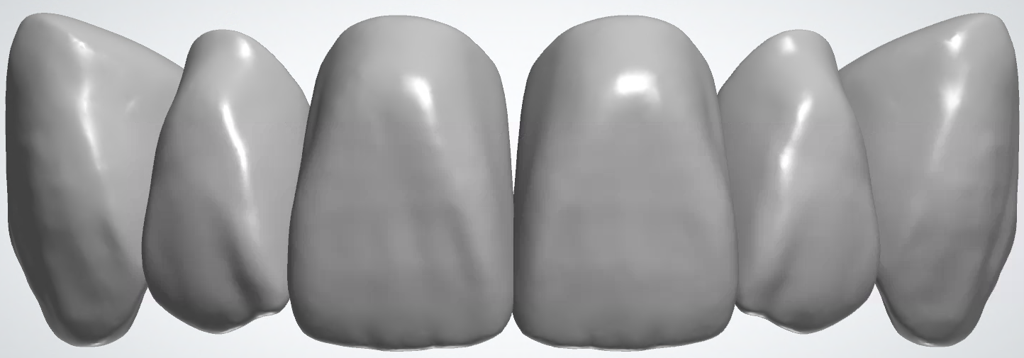 blobid434.png
