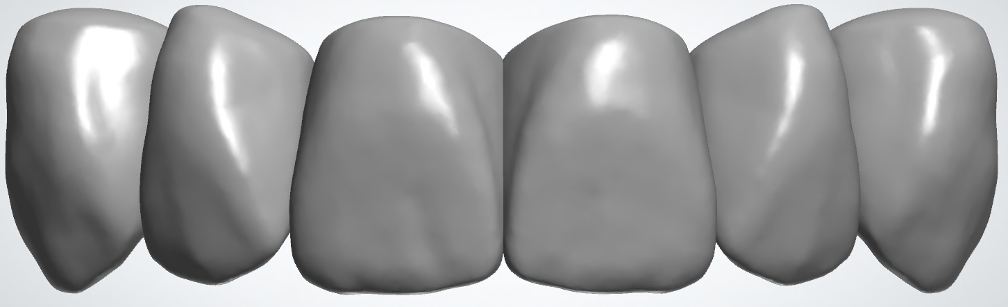 blobid438.png