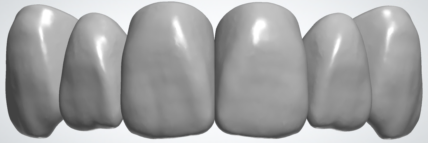 blobid442.png
