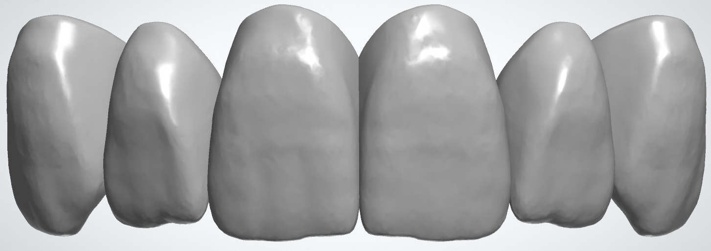 blobid444.png