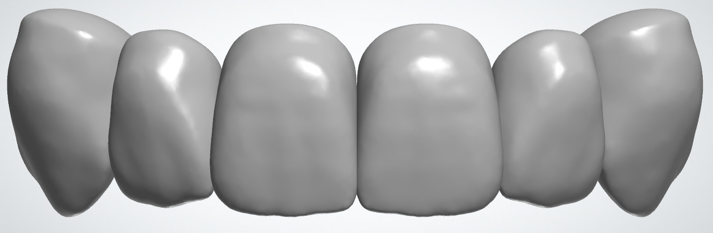 blobid448.png