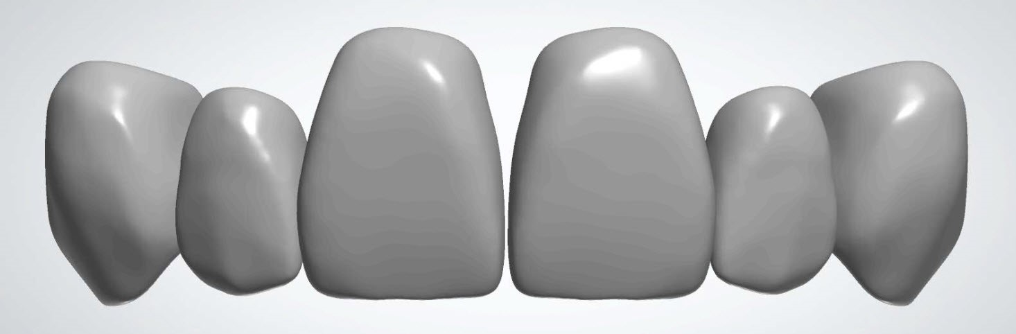 3Shape Dental System - Libraries – 3Shape Design Services