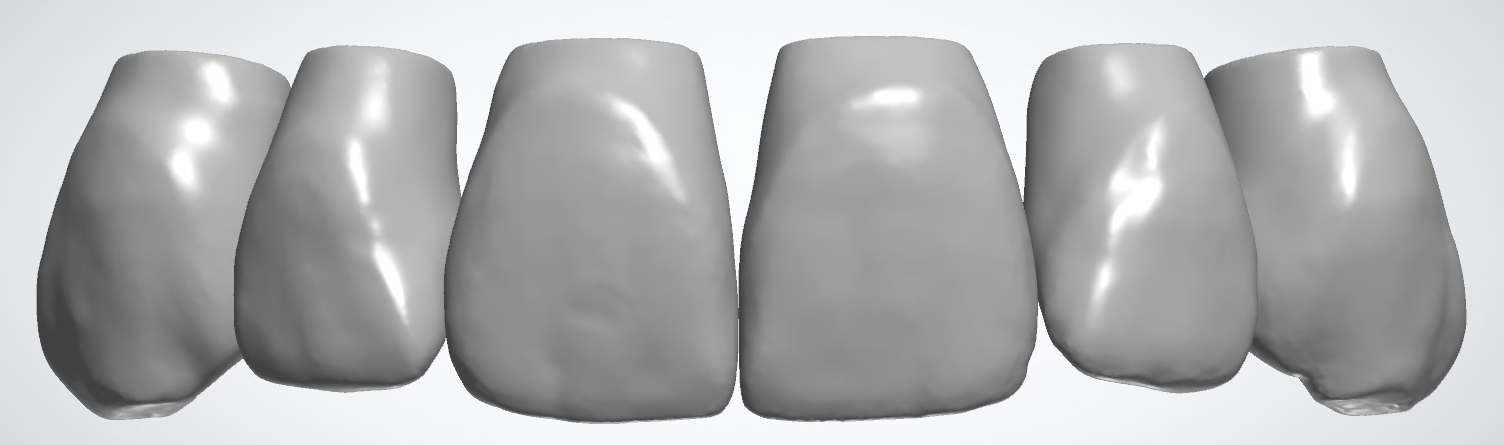 blobid145.png