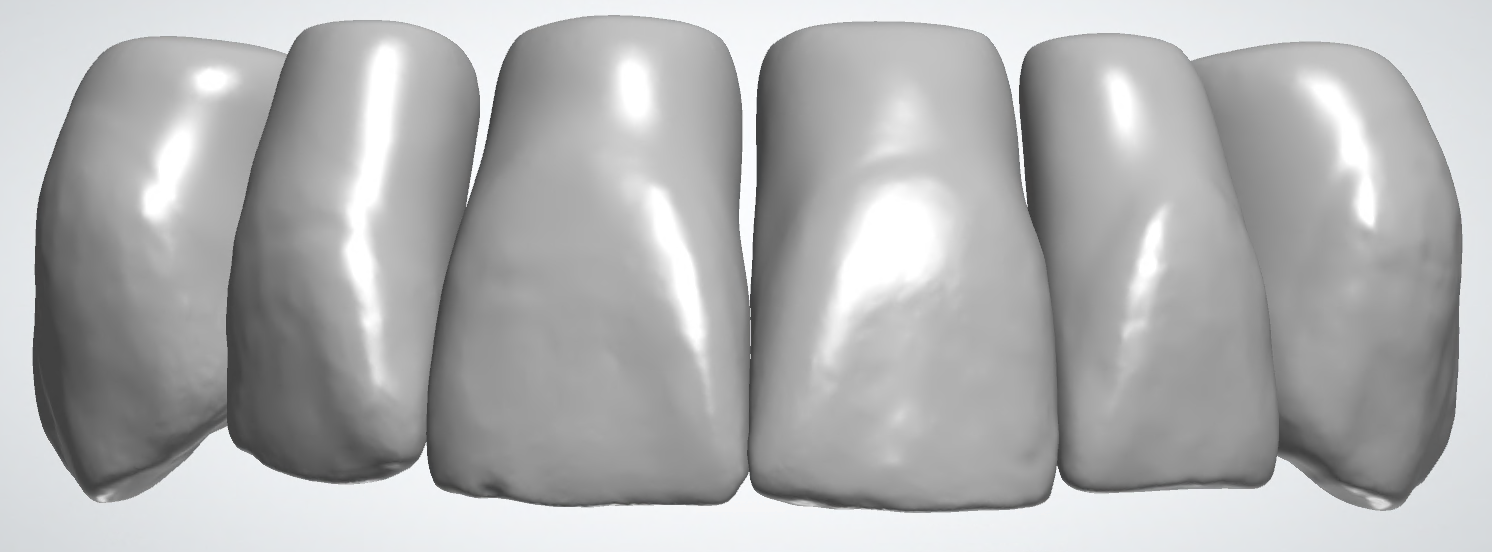 blobid152.png