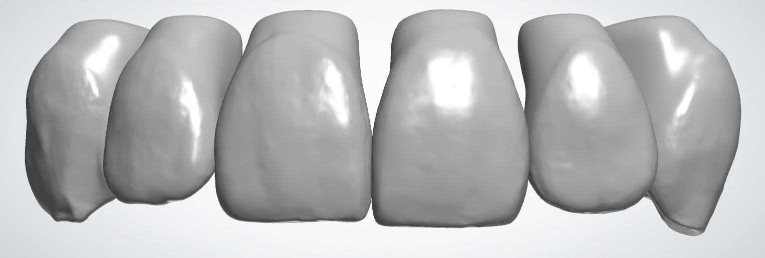 blobid180.png