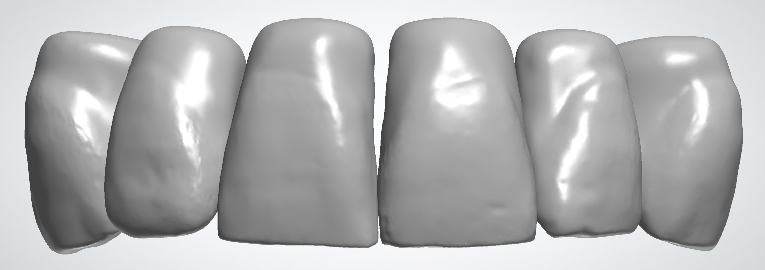 blobid236.png