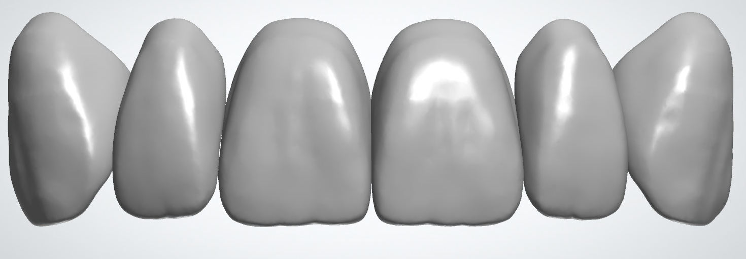 blobid279.png