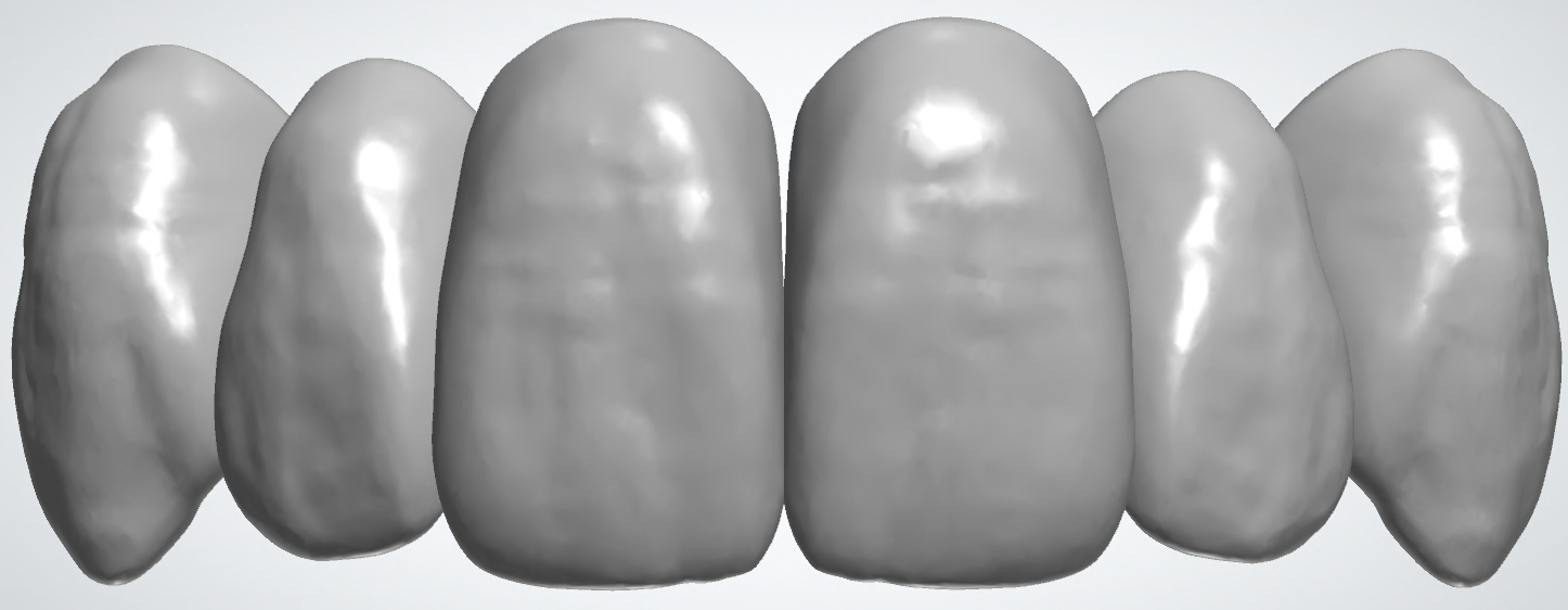 blobid418.png