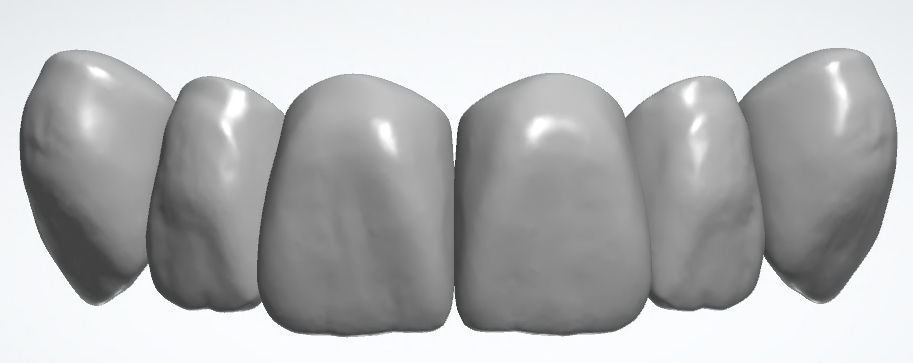 blobid426.png