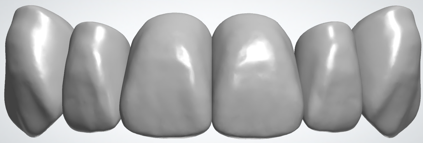 blobid430.png