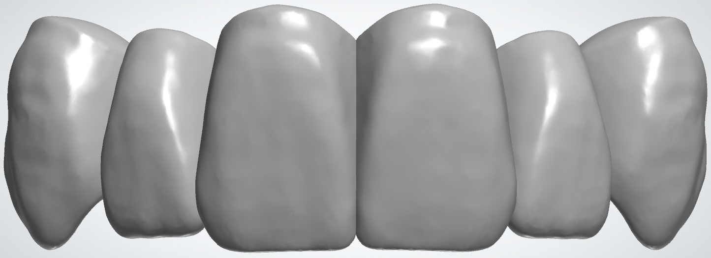 blobid432.png