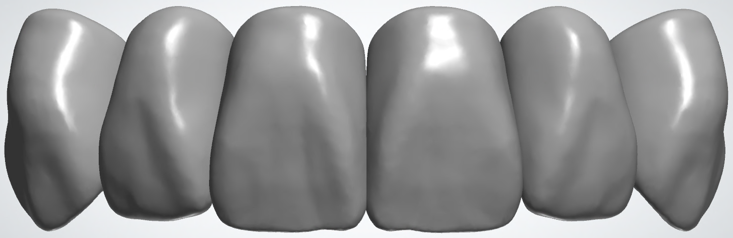 blobid436.png
