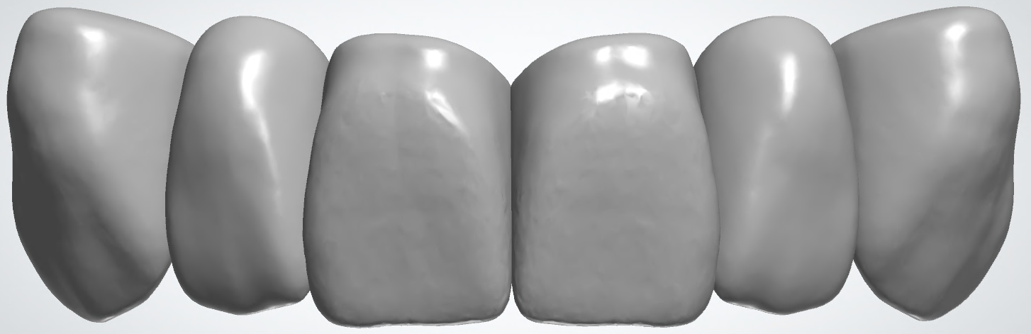 blobid440.png