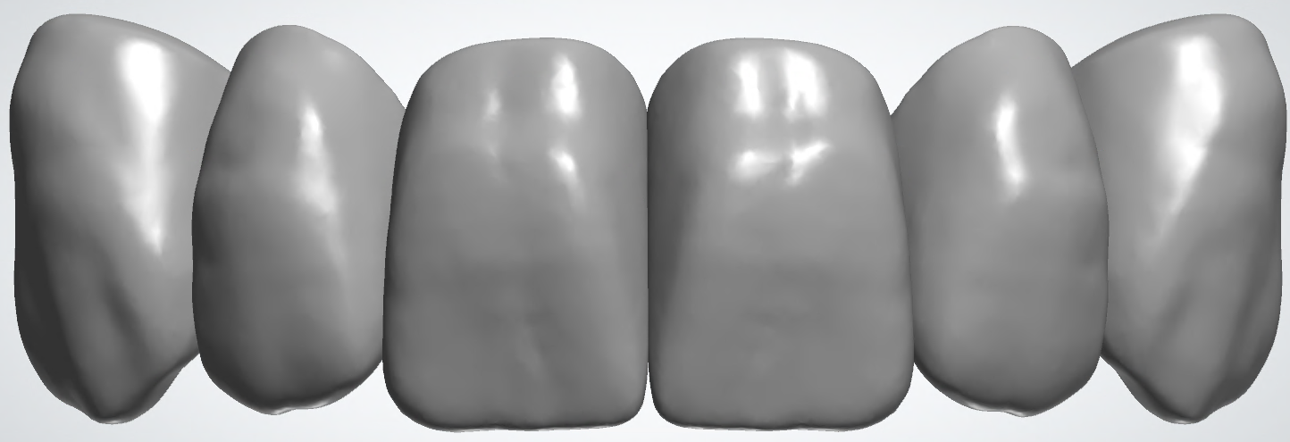 blobid446.png