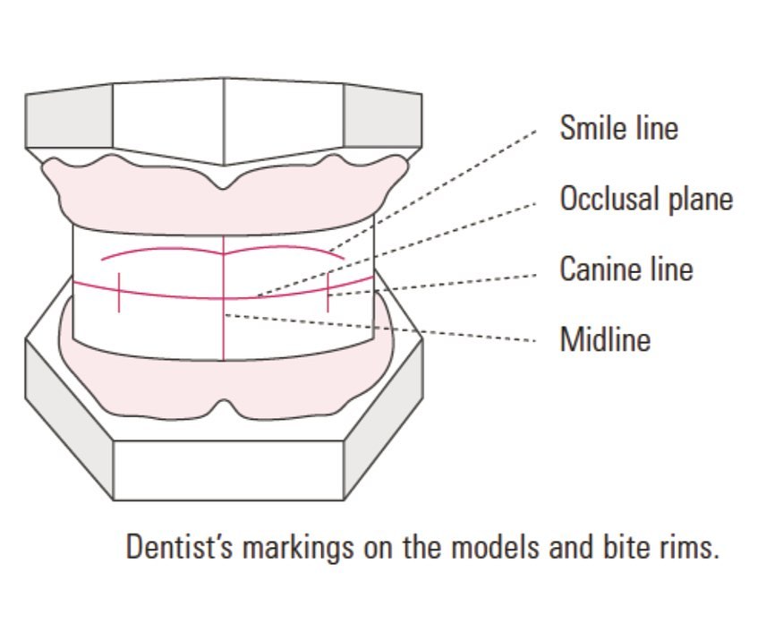 Dentures Denture Bite Registration Markings 3Shape Design Services