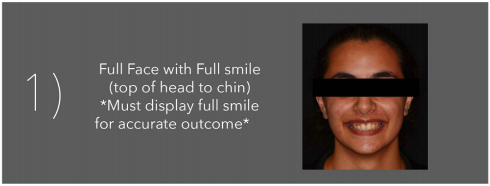 Crown and Bridge - Sending a Smile Design Case to the 3Shape Design ...