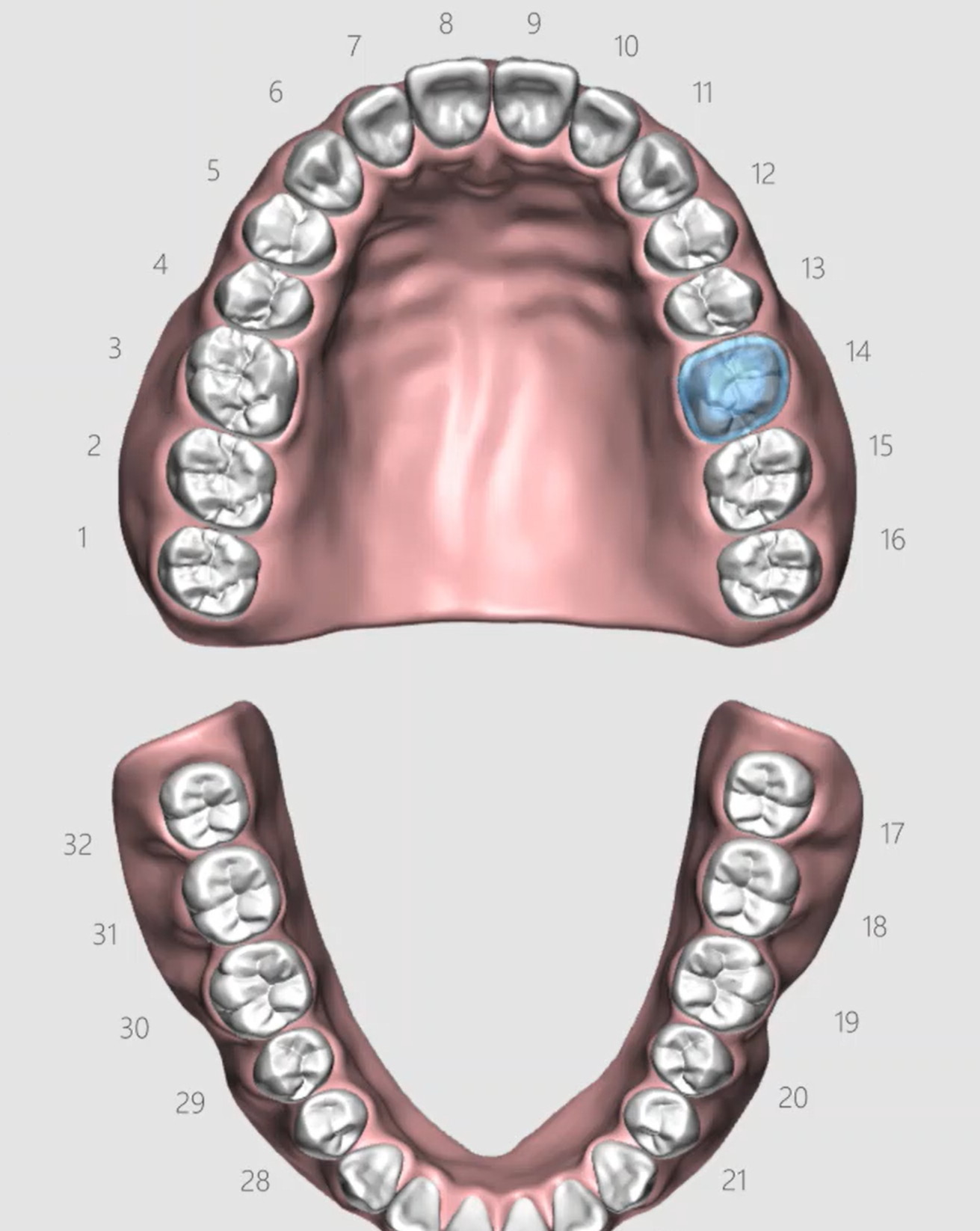 Clinic Support - How to send a Case to 3Shape Design Services – 3Shape ...