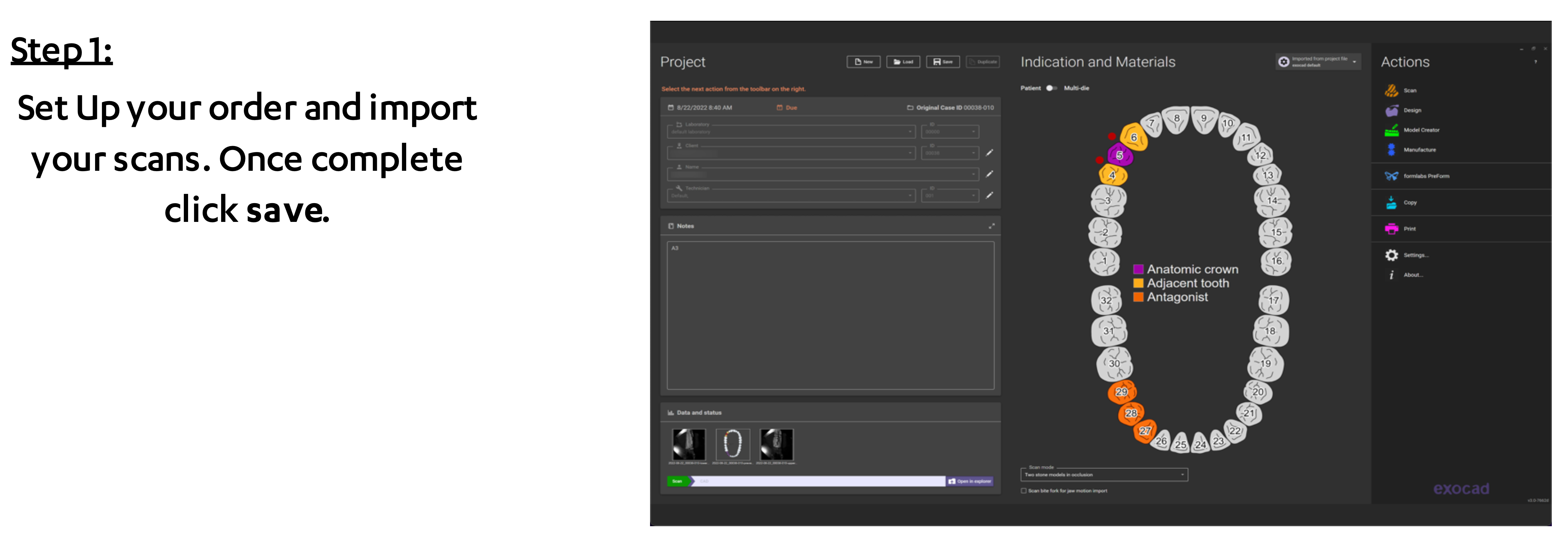 3Shape Design Service Platform - How to send an Exocad case for Design ...