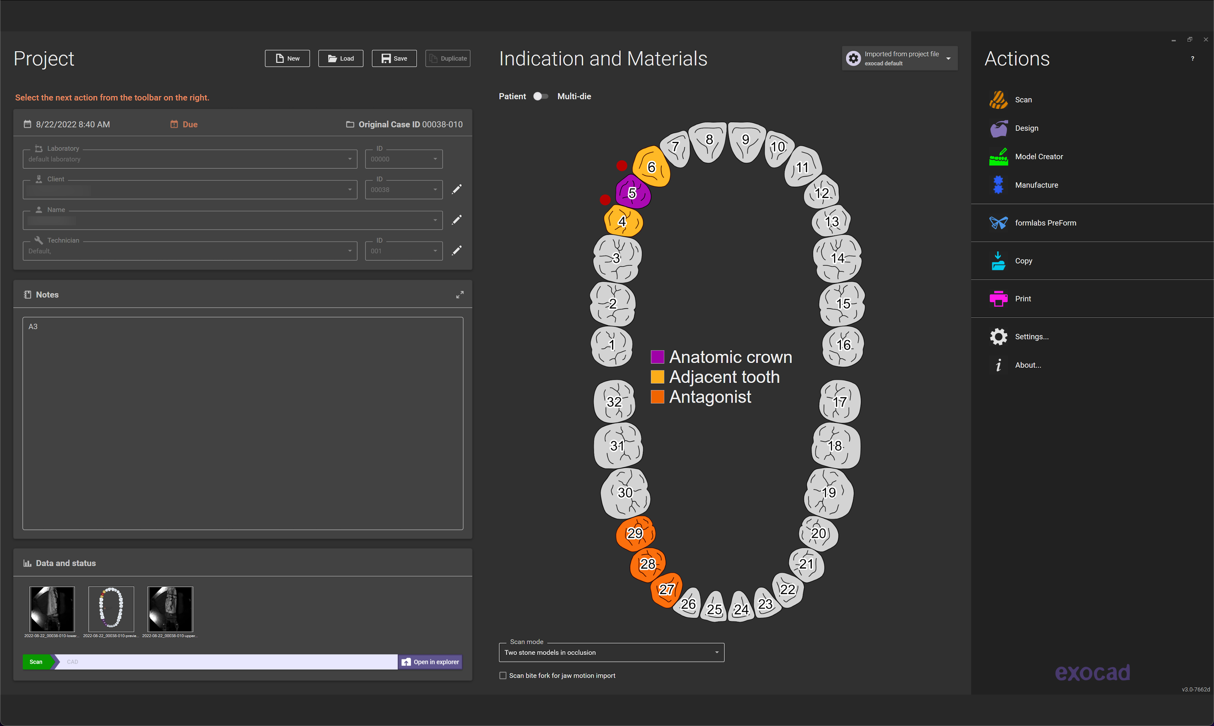 3shape automate exocad order workflow 3shape design services